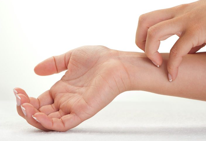 What you need to know to control eczema flare-ups in summer.