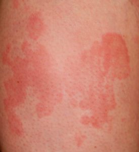 a5a59531-295f-4a56-a768-dd36a6f694aa