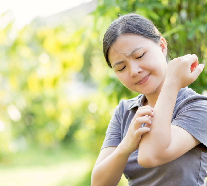 Woman scratching her arm.