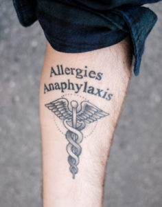 Matt got a "medical alert" tattoo after his reaction and ambulance incident.